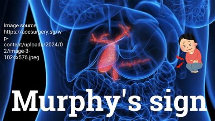 What is McMurphy a symbol of?