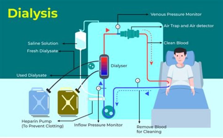 What is removed during dialysis?