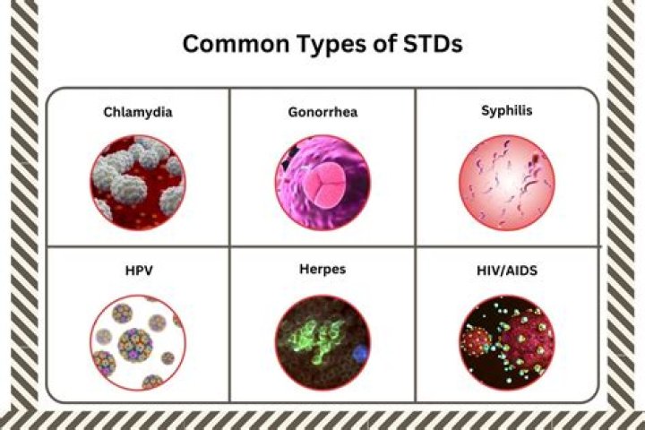 What is the most common STD among high school students?