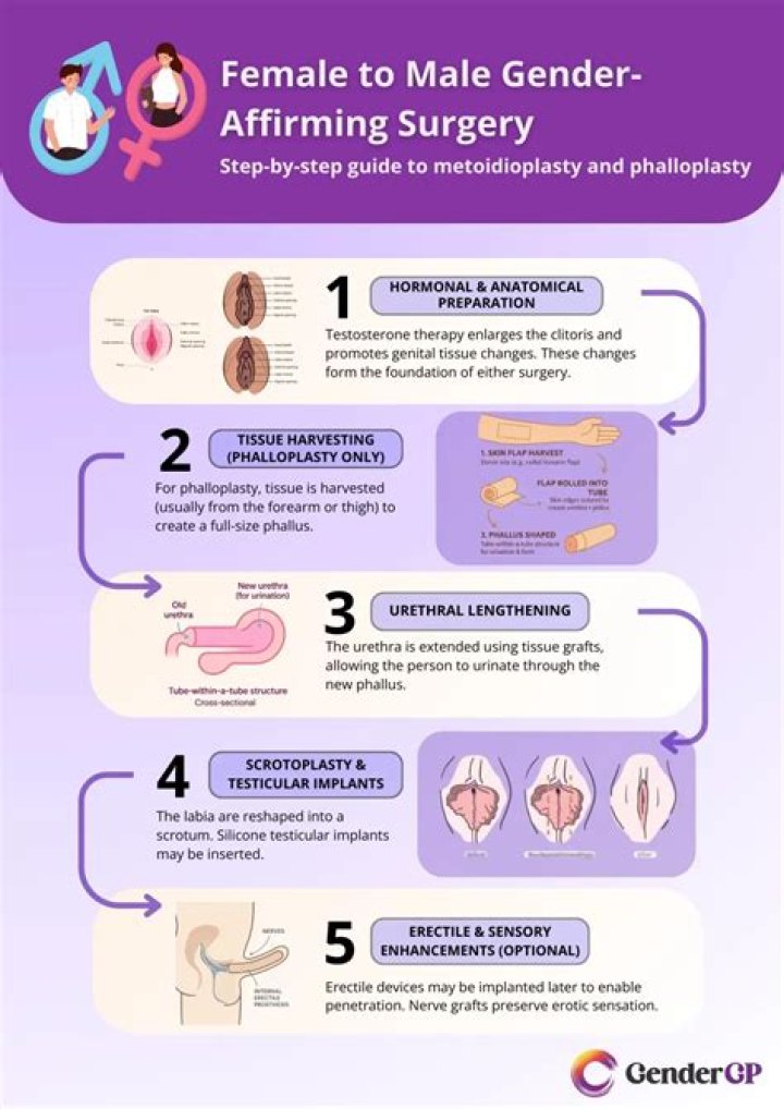 What is top surgery for a woman?