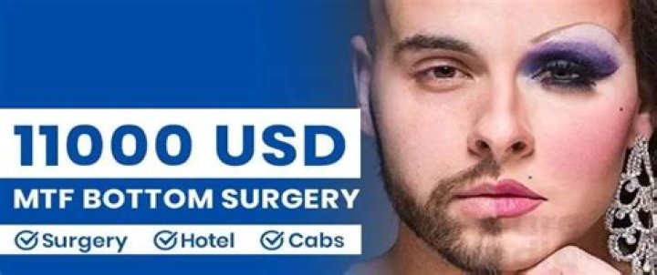 What is top surgery male to female?