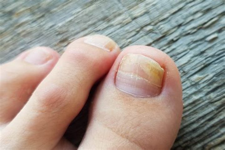What is under your toenail?