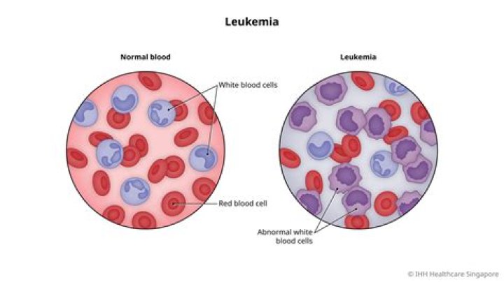 What labs indicate leukemia?