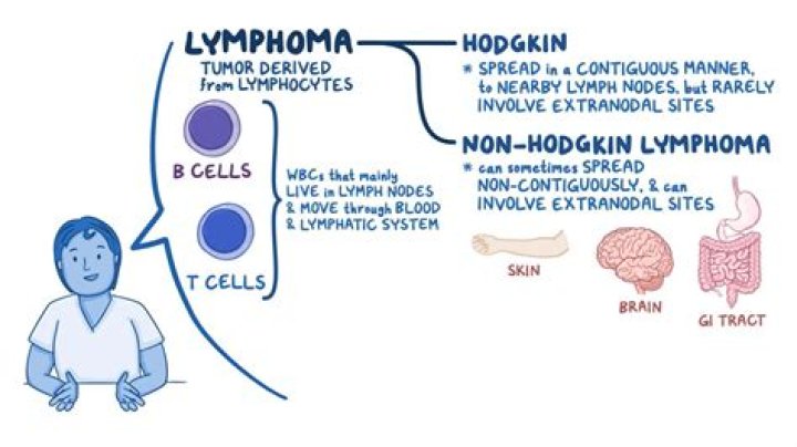 What part of the body does Hodgkin's lymphoma affect?
