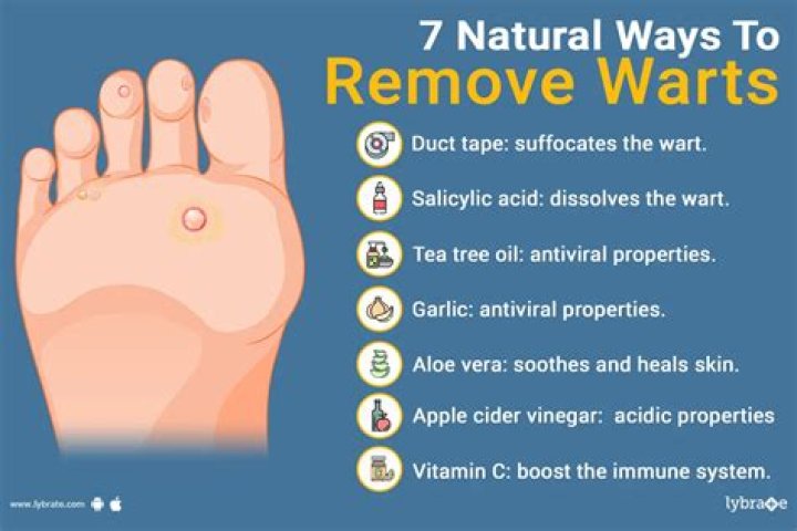 What Supplements Help With warts?