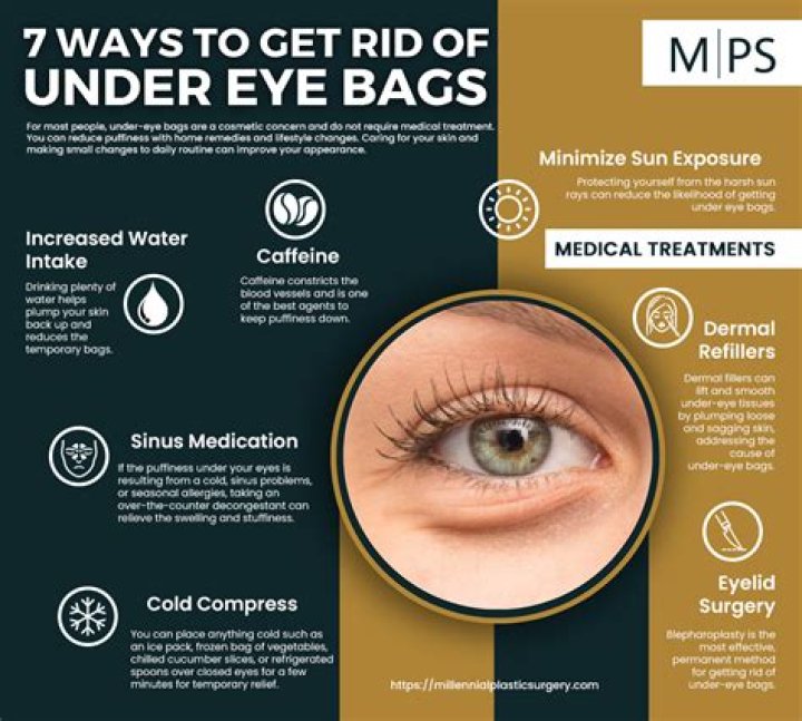 What time should I sleep to get rid of Eyebags?