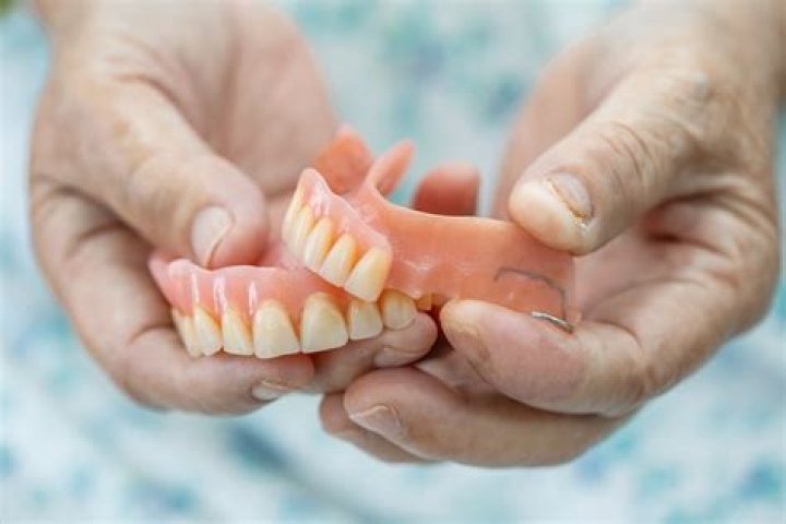 What to expect when getting dentures for the first time?
