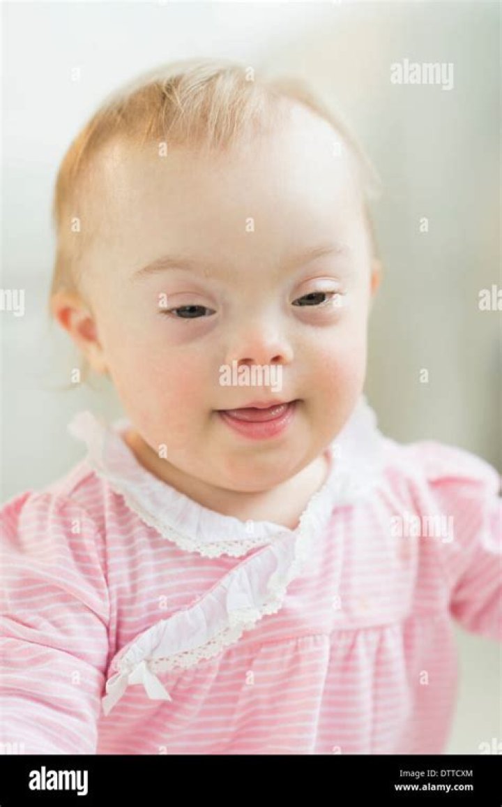 When are most babies with Down syndrome born?