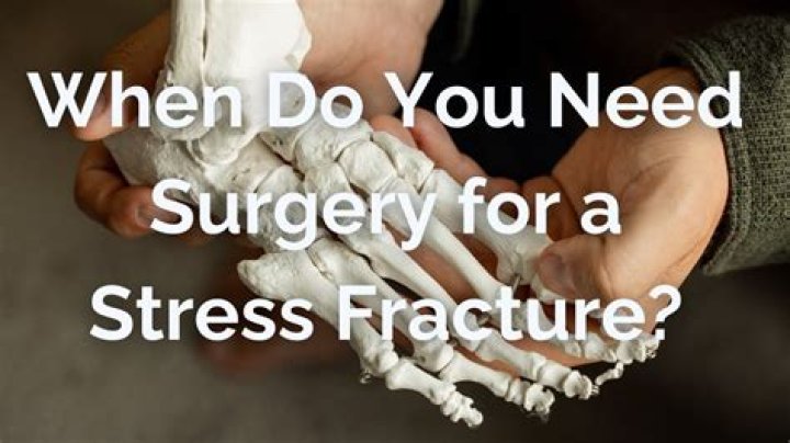 When do you need surgery for nerve damage?
