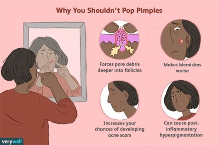 When I pop a pimple something hard comes out?