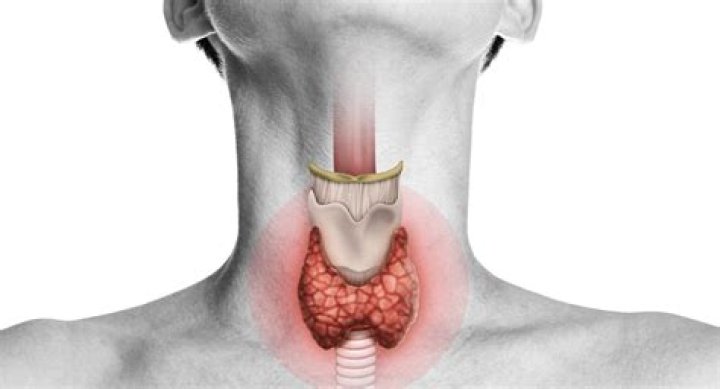 When Should thyroid be removed?