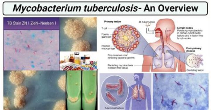 Where did tuberculosis come from?