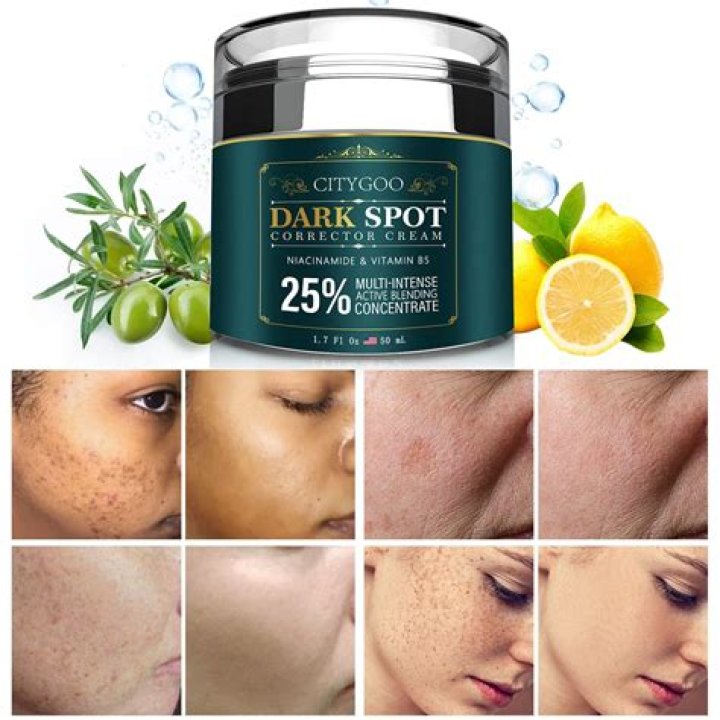 Which face cream is best for dark spots?