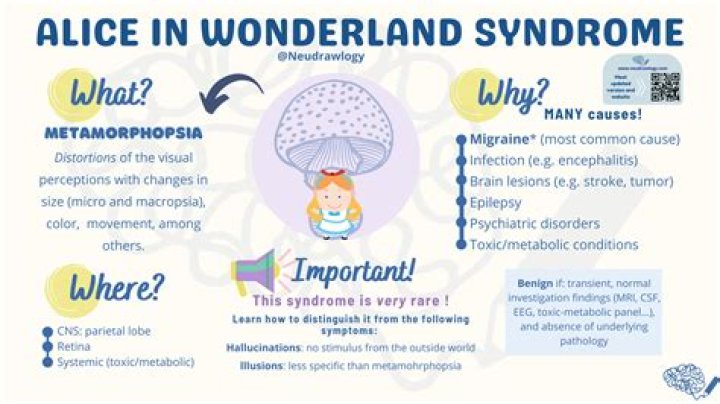 Who is most likely to get Alice in Wonderland syndrome?