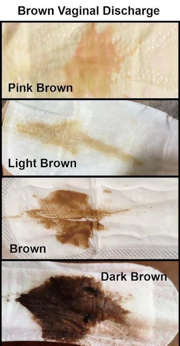 Why am I having brown discharge for a week?