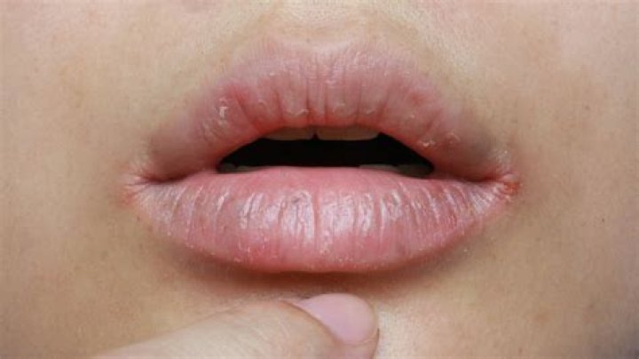Why are Mentats lips red?