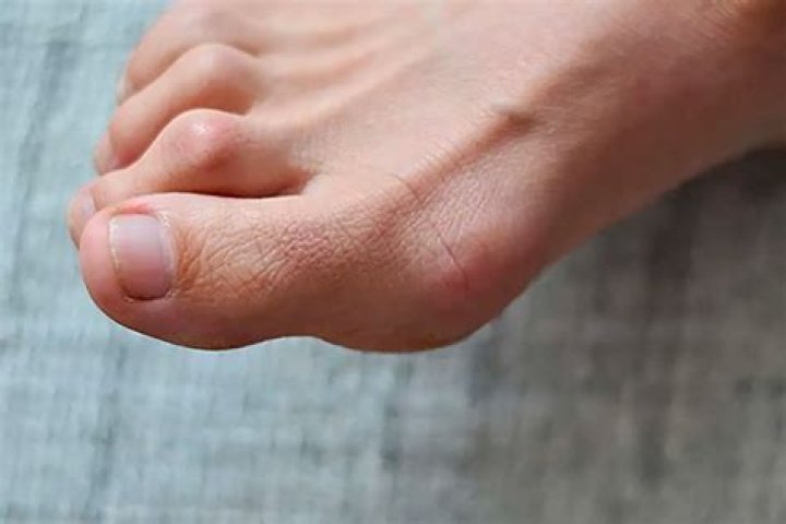 Why are my big toes not flexible?