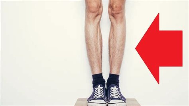 Why are my legs so skinny?