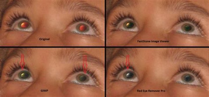 Why do eyes turn me?