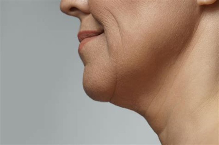 Why do I have no jawline?