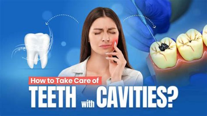 Why do I keep getting cavities when I take care of my teeth?