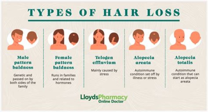Why do I lose hair so much?