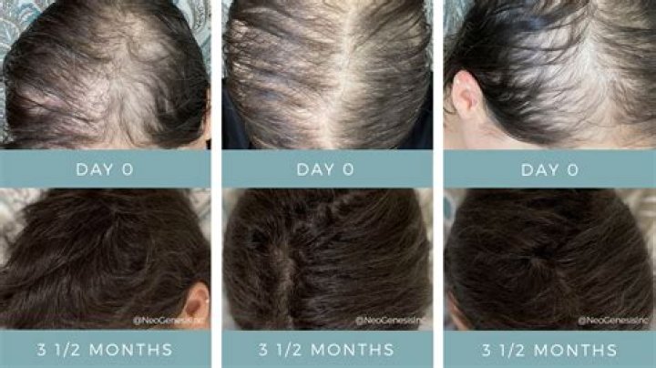 Why do I lose more hair when I oil it?