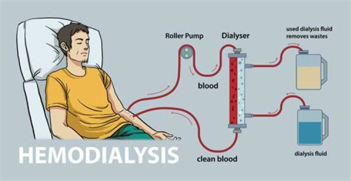 Why does dialysis take 4 hours?