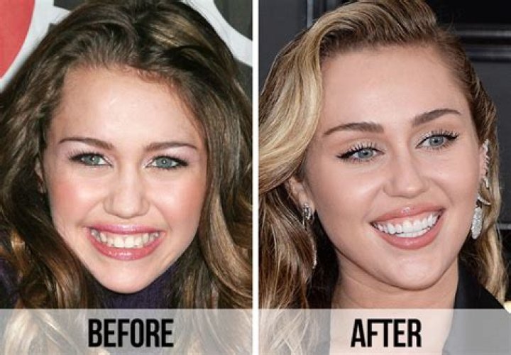 Why does everyone's teeth look so white?