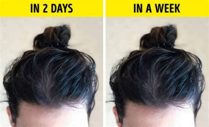 Why does my hair go greasy after 1 day?