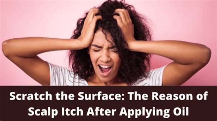 Why does my scalp itch after applying castor oil?