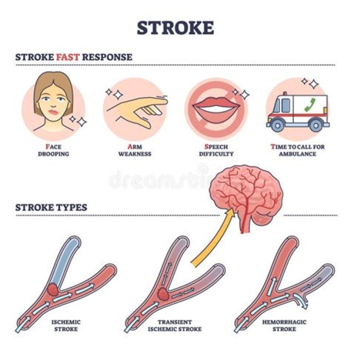 Why does stroke happen at night?