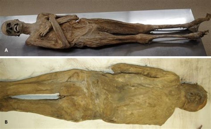 Why is an embalmed body so hard?