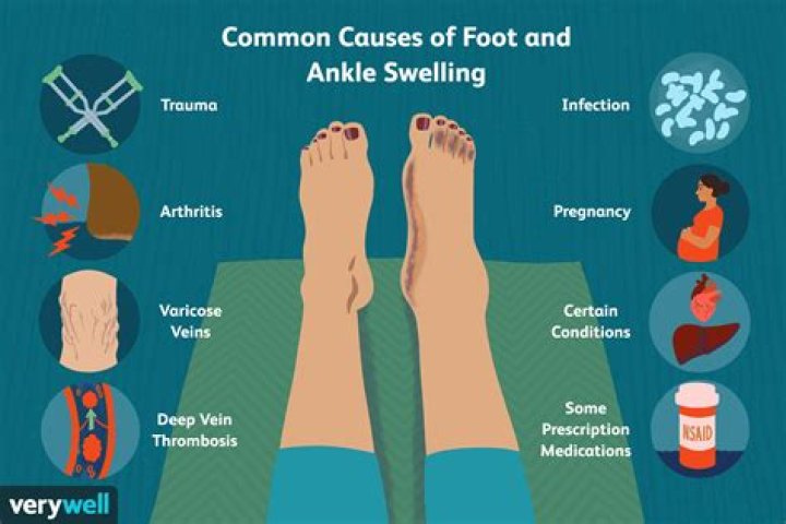 Why is my ankle still swollen after 4 weeks?