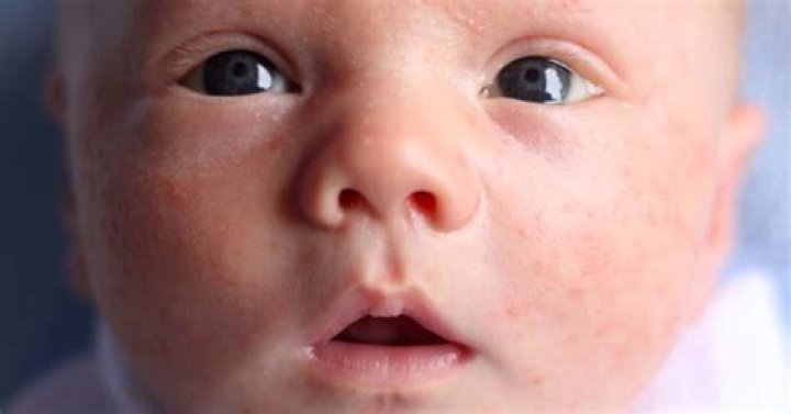 Why is my baby red?