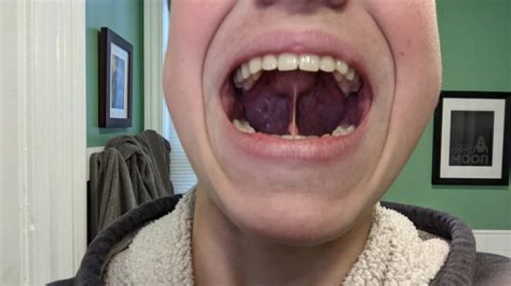 Why is my tongue dirty?