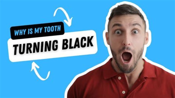 Why is my tooth black at the gum line?