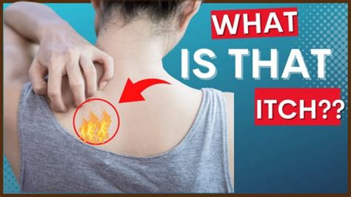 Why my back is so itchy?