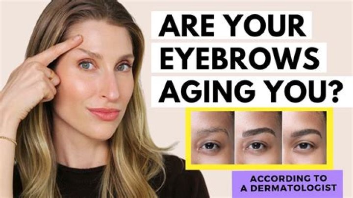 Why my eyebrows are joined together?