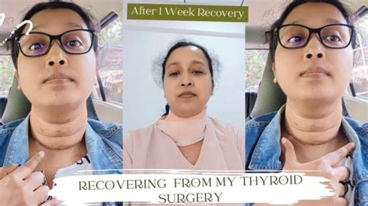 Will I gain weight after thyroid removal?